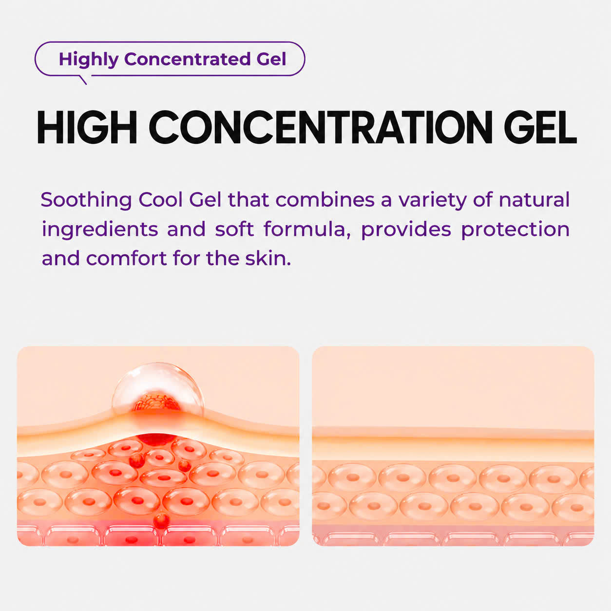 Kreain Nature Hemorrhoid Gel Helps Reduce Itching, Burning, and Dryness in Sensitive Areas, Effective Herbal Gel for Soothing Swelling and Heat 20g
