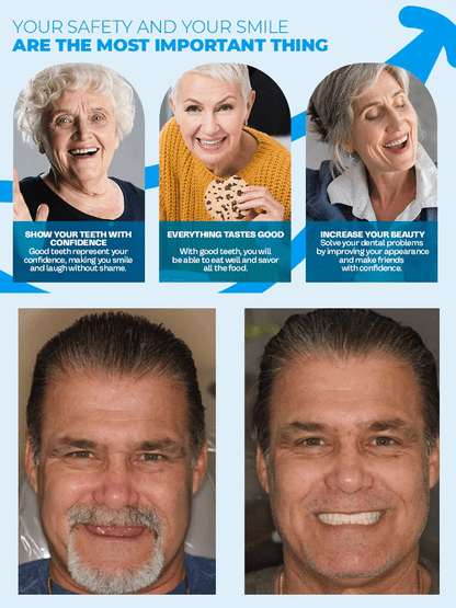 Premium Smart Denture Set: Mold a Secure, Slip-Free Fit at Home in Just 2 Minutes